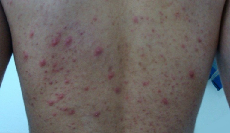 Ahmed | Dermatology Oasis